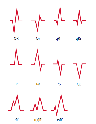 10分钟掌握标准心电图的基础知识 qrs复合波的波形方向或偏移决定了加