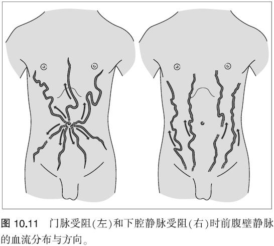 正常腹壁静脉血流图图片